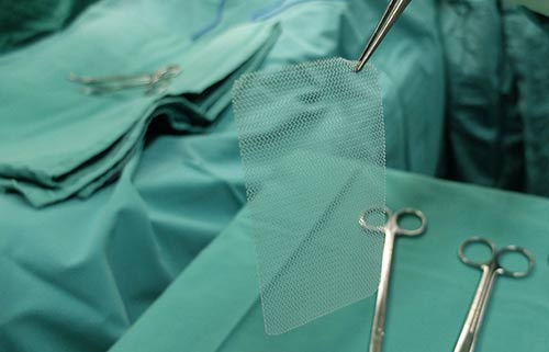 Keith Law will guide you through filing an Arkansas hernia mesh lawsuit.